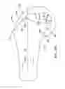 Fig. 76 - Systems and methods for providing an asymmetrical tibial component