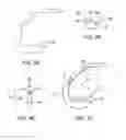 Fig. 05 - Systems and methods for providing a femoral component with a modified posterior condyle