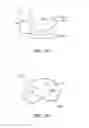 Fig. 14 - Systems and methods for providing a femoral component with a modified posterior condyle