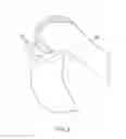 Fig. 16 - Systems and methods for providing a femoral component with a modified posterior condyle