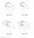 Fig. 17 - Systems and methods for providing a femoral component with a modified posterior condyle