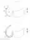 Fig. 22 - Systems and methods for providing a femoral component with a modified posterior condyle
