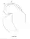 Fig. 24 - Systems and methods for providing a femoral component with a modified posterior condyle