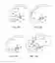 Fig. 27 - Systems and methods for providing a femoral component with a modified posterior condyle