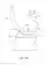 Fig. 30 - Systems and methods for providing a femoral component with a modified posterior condyle
