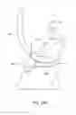 Fig. 31 - Systems and methods for providing a femoral component with a modified posterior condyle