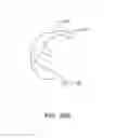 Fig. 41 - Systems and methods for providing a femoral component with a modified posterior condyle