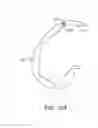 Fig. 43 - Systems and methods for providing a femoral component with a modified posterior condyle