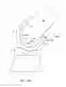Fig. 47 - Systems and methods for providing a femoral component with a modified posterior condyle