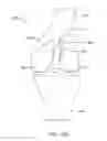 Fig. 53 - Systems and methods for providing a femoral component with a modified posterior condyle