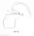 Fig. 63 - Systems and methods for providing a femoral component with a modified posterior condyle