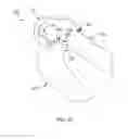 Fig. 64 - Systems and methods for providing a femoral component with a modified posterior condyle