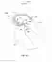 Fig. 67 - Systems and methods for providing a femoral component with a modified posterior condyle