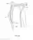 Fig. 69 - Systems and methods for providing a femoral component with a modified posterior condyle
