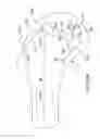 Fig. 74 - Systems and methods for providing a femoral component with a modified posterior condyle