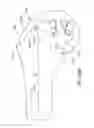 Fig. 75 - Systems and methods for providing a femoral component with a modified posterior condyle