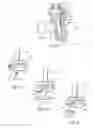 Fig. 05 - Ankle replacement system
