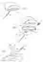 Fig. 06 - Ankle replacement system