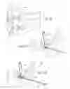 Fig. 19 - Ankle replacement system