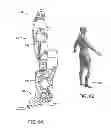 Fig. 07 - Biomimetic transfemoral prosthesis