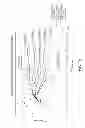 Fig. 08 - Biomimetic transfemoral prosthesis