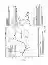 Fig. 09 - Biomimetic transfemoral prosthesis