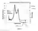 Fig. 02 - Acoustic-Pulser Feedback and Power Factor Control of a HIFU Device