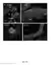 Fig. 30 - Modified arthropod and method of use