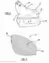 Fig. 07 - System for calculating forefoot wedge angle to correct pronation/supination