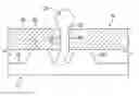 Fig. 01 - Elastic retaining assembly for matable components and method of assembling