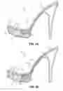 Fig. 02 - Footwear with metatarsal offloading