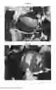 Fig. 09 - Microalgae-based soil inoculating system and methods of use