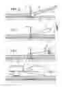 Fig. 04 - Device for leveling and aligning tile and method for leveling and aligning tiles