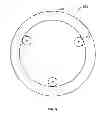 Fig. 09 - System and method for plugging core holes