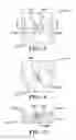 Fig. 03 - TORQUE TOOL