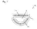 Fig. 08 - Adjustable neck stiffener for stringed musical instruments