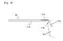 Fig. 16 - Adjustable neck stiffener for stringed musical instruments