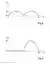 Fig. 03 - Pump Element of a Hydraulic Unit for a Vehicle Brake System