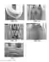 Fig. 20 - Methods and devices for coating stents