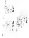 Fig. 23 - Cannula for minimizing dilution of dosing during nitric oxide delivery