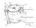 Fig. 01 - Brush assembly