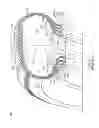 Fig. 02 - Tire with multiple bead cores and locking insert