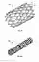 Fig. 03 - Expandable device for use in a well bore
