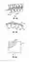 Fig. 14 - Expandable device for use in a well bore
