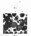 Fig. 04 - Crowns for earth-boring casing shoes, earth-boring casing shoes, and methods of forming earth-boring casing shoes