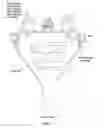 Fig. 10 - Plasma whirl reactor apparatus and methods of use