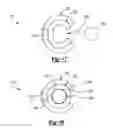 Fig. 09 - Wrap bracket damper assembly