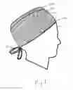 Fig. 02 - PARTICLE RADIATION SHIELDING HEAD COVER