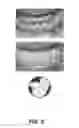 Fig. 04 - Dental block