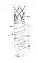 Fig. 08 - PTFE layers and methods of manufacturing